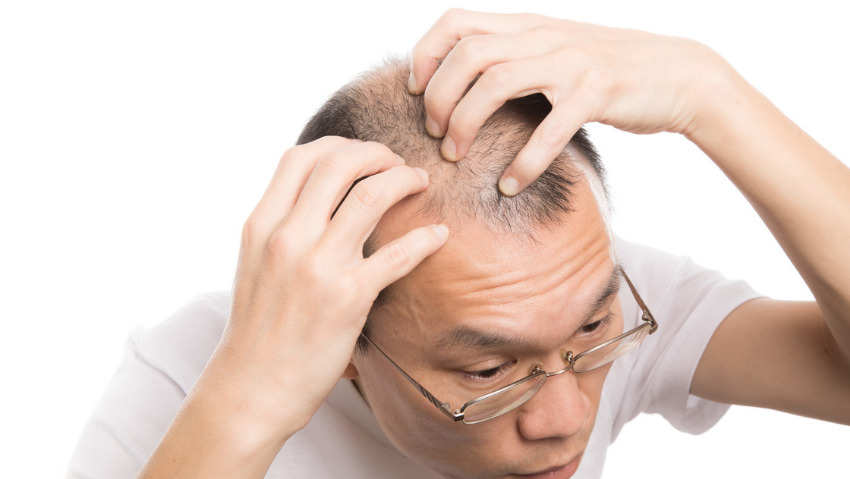 デュタステリド