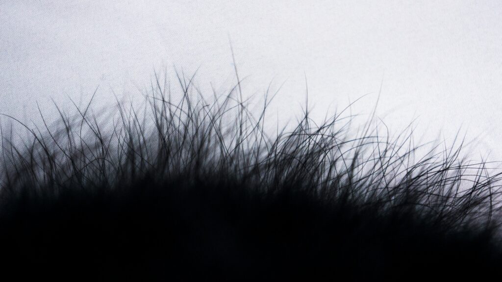 AGAの主な治療方法