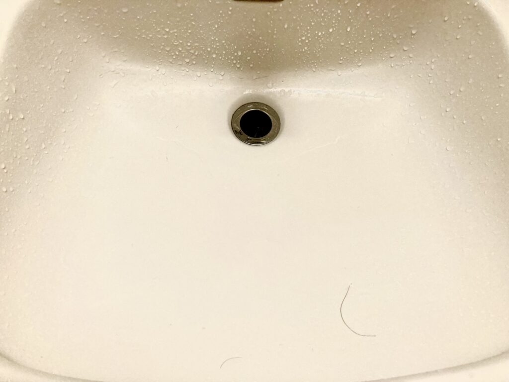 AGAセルフチェックリスト7項目