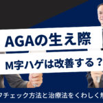 AGAの生え際の特徴とは？M字はげのチェックリストと治療方法