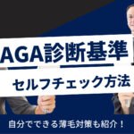 AGA・はげの診断基準は？｜セルフチェックと自分でできる対策